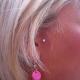 implant10