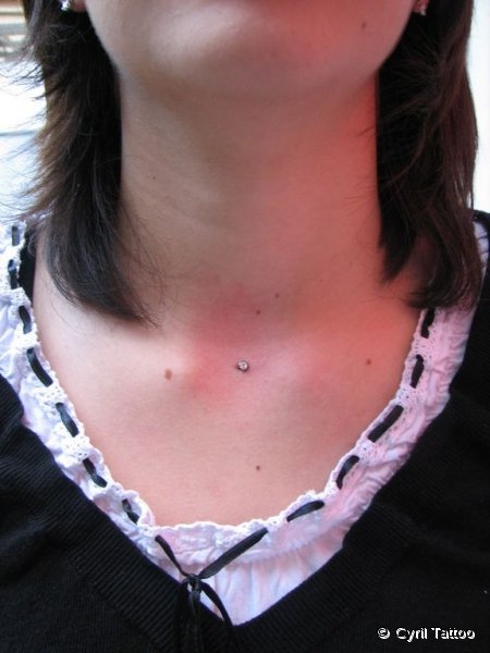 implant04