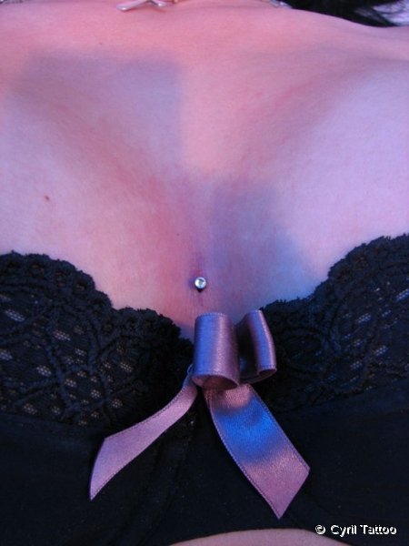 implant08