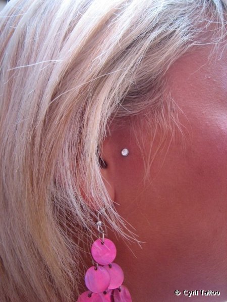 implant10